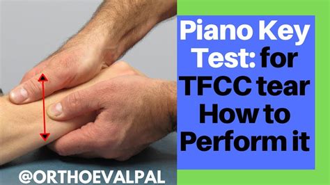 tests for tfcc tear|positive test for tfcc.